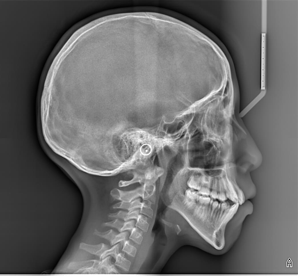 Radiografía Dental Profesional
