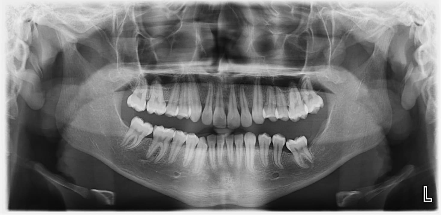 Tecnología Dental